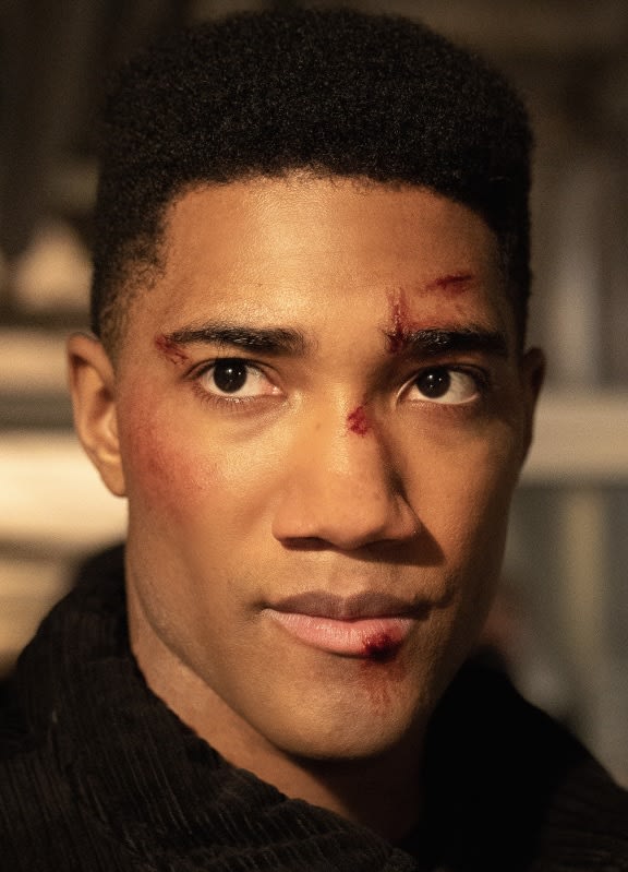 Raines With an Injury