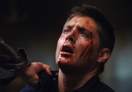Bloody Dean