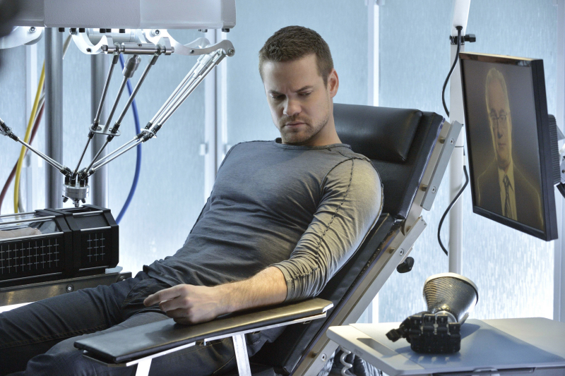 Considering Prosthetic