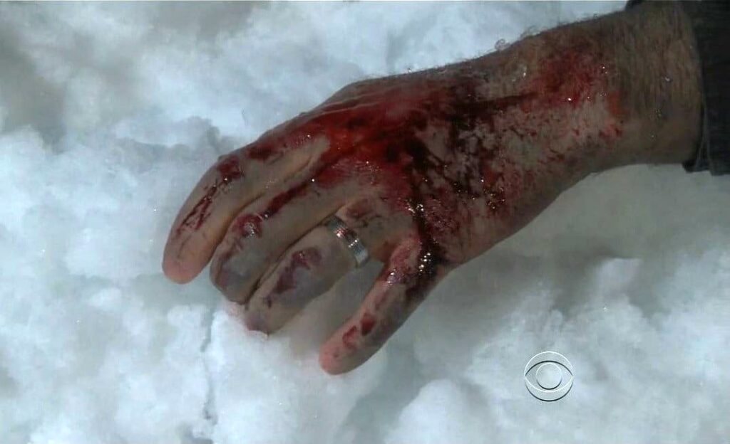 Bloody Finger