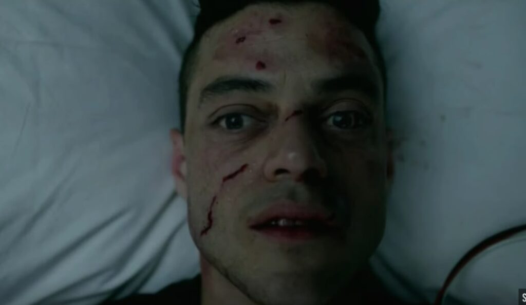 Elliot in Pain - Mr. Robot Season 2 Episode 6