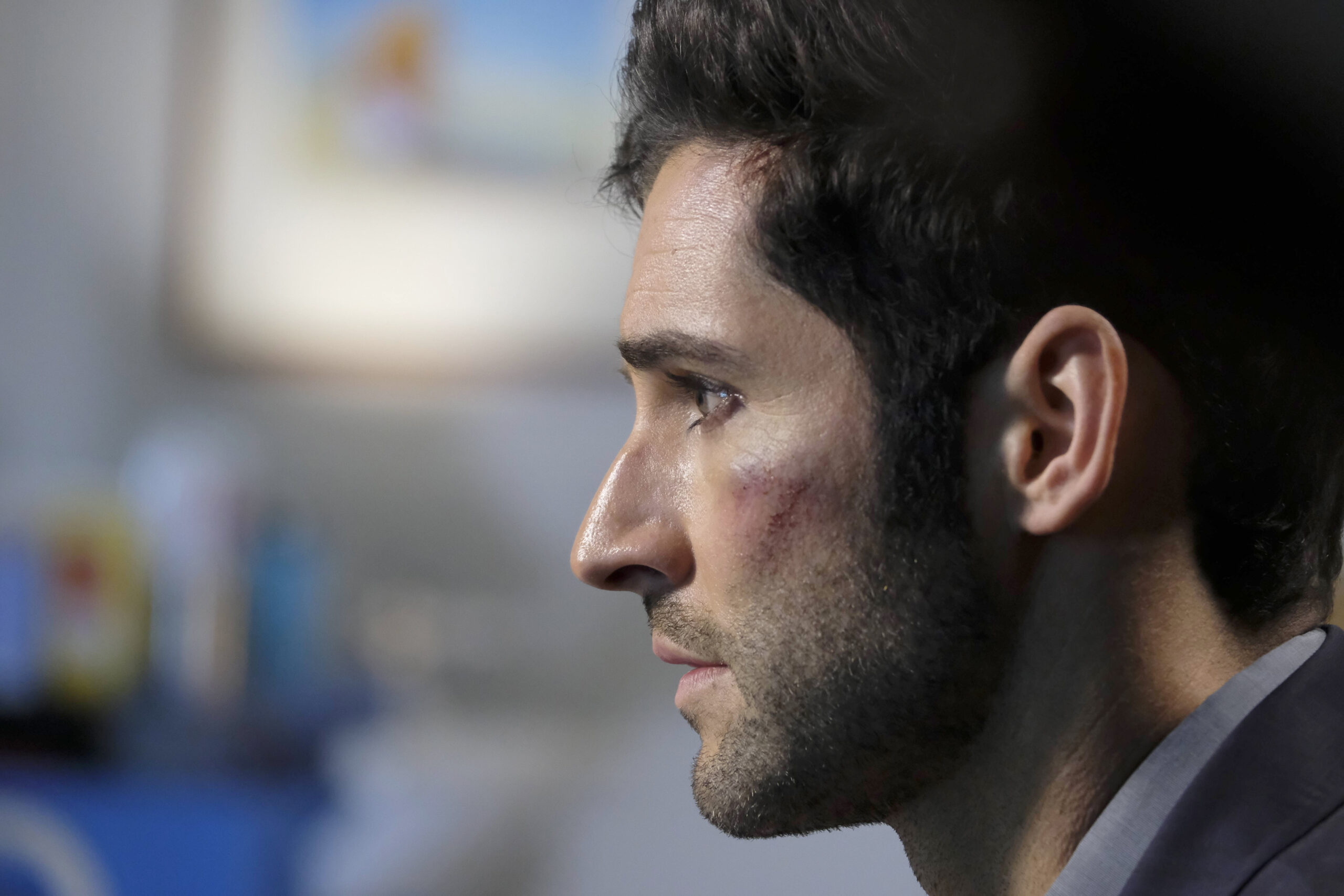 It's All Too Much - Lucifer Season 2 Episode 18