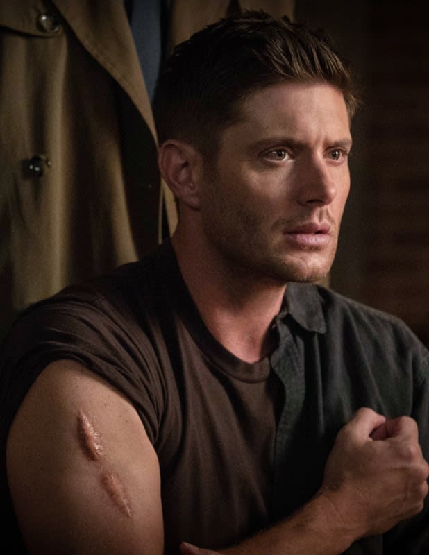 Another Scar - Tall - Supernatural Season 14 Episode 3