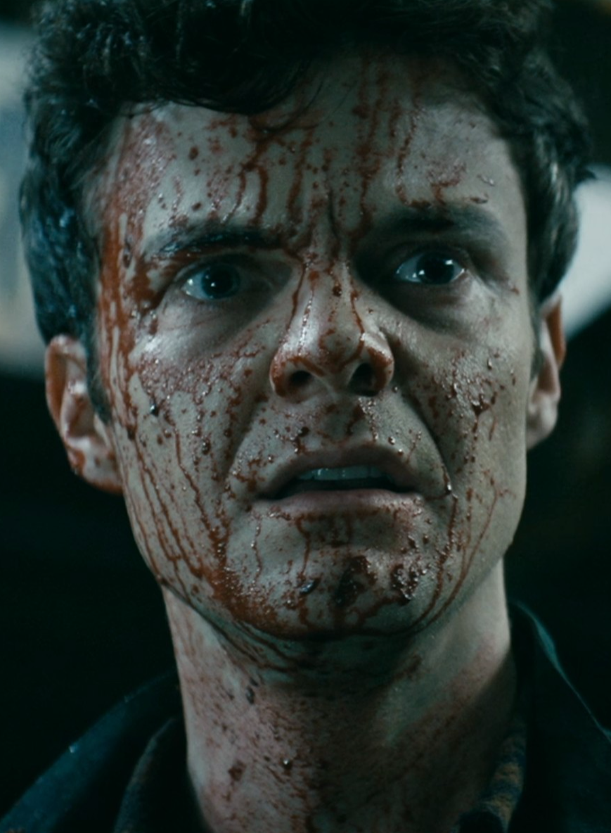 Hughie's face was covered in blood.